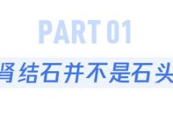 有这些习惯的人，很容易被肾结石盯上